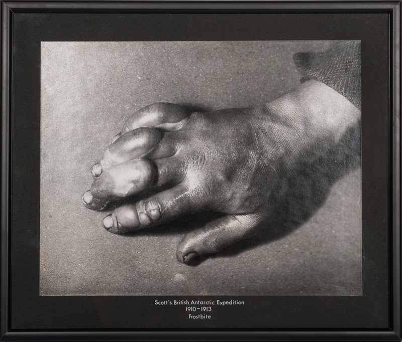 Classic Herbert Ponting photograph from Captain Scott's Terra Nova expedition (1910-1913), showing the effects of frostbite on the hand of a team member