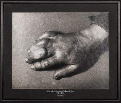 Classic Herbert Ponting photograph from Captain Scott's Terra Nova expedition (1910-1913), showing the effects of frostbite on the hand of a team member