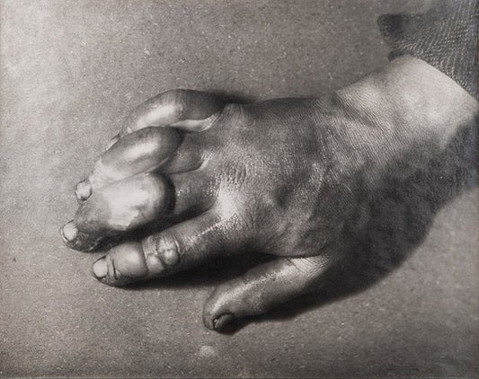 Classic Herbert Ponting photograph from Captain Scott's Terra Nova expedition (1910-1913), showing the effects of frostbite on the hand of a team member