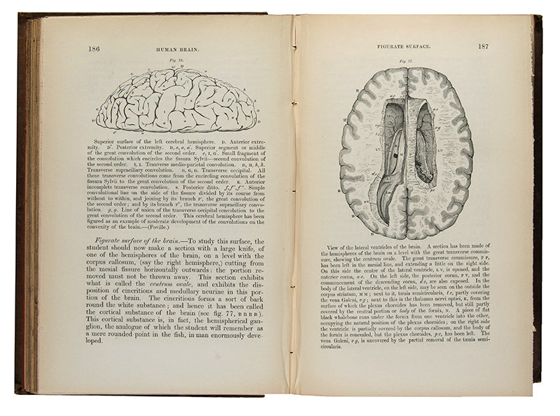 Second edition, inscribed presentation copy of Samuel Solly's important work on neurology, The Human Brain, from the library of Oliver Sacks, with his octopus bookplate.