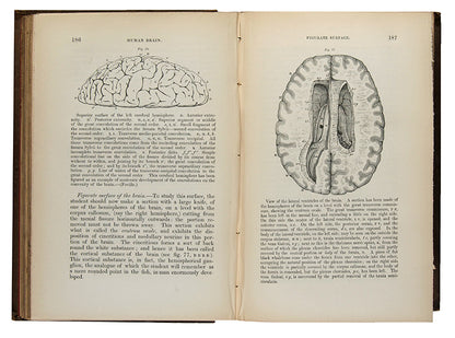 Second edition, inscribed presentation copy of Samuel Solly's important work on neurology, The Human Brain, from the library of Oliver Sacks, with his octopus bookplate.