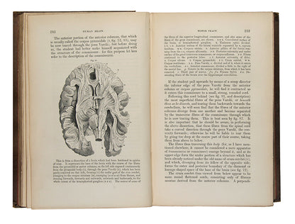 Second edition, inscribed presentation copy of Samuel Solly's important work on neurology, The Human Brain, from the library of Oliver Sacks, with his octopus bookplate.