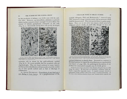 First edition of A Classification of the Tumors of the Glioma Group by pioneering neurosurgeons Percival Bailey and Harvey Cushing.