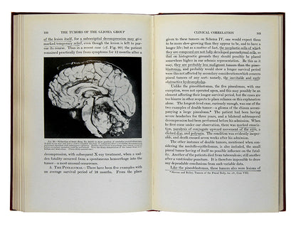 First edition of A Classification of the Tumors of the Glioma Group by pioneering neurosurgeons Percival Bailey and Harvey Cushing.