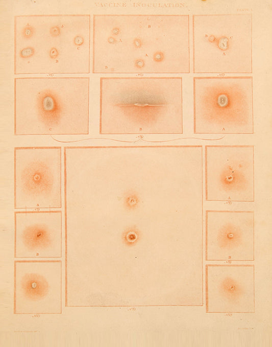 First edition one of the earliest detailed accounts of vaccination, On Vaccine Inoculation by Robert Willan, the founder of dermatology.