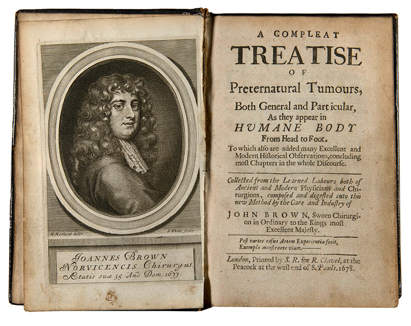 The rare first edition of A Compleat Treatise of Preternatural Tumours, a 17th-century work on cancer treatment by the surgeon-in-ordinary to Charles II, John Browne.