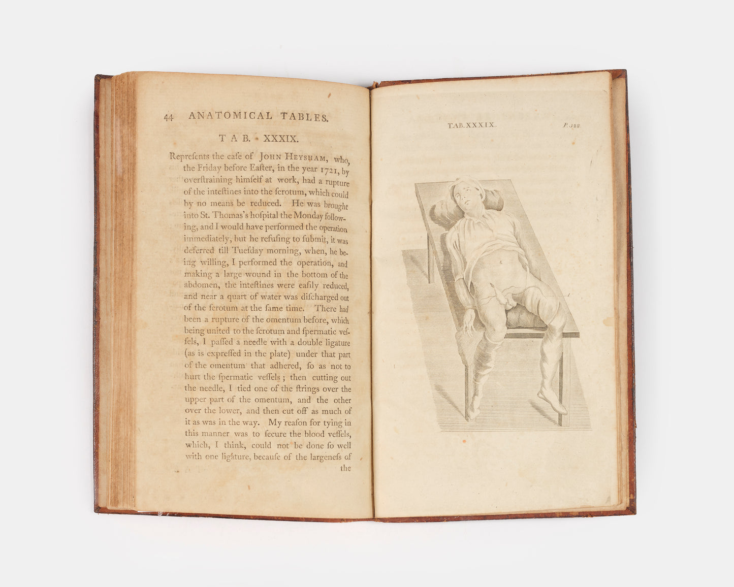 A rare, early American edition of surgeon William Cheselden's The Anatomy of the Human Body (1913), published in 1796 under the title Anatomical Tables of the Human Body.